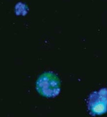 Figure 2. THP-1 cells were stained with Poly (active) Caspase FAM FLICA® Inhibitor Reagent (green), and Hoechst 33342 (Blue). Cells were incubated with staurosporine to induce apoptosis. Two photos were taken and superimposed. Only one cell of the three cells is apoptotic (middle) – it is stained positive for caspase activity with FAM-VAD-FMK. Data courtesy of Dr. Brian W. Lee.