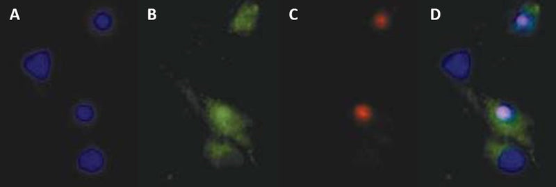 Figure 4. Cell death in primary rat hippocampal neurons. (D) is a composite of FLICA® FAM-DEVD-FMK (B), PI (C), and Hoechst (D). DNA is labeled in 4 cells (A), 3 cells are caspase-positive (B), 2 are membrane-compromised (C). One cell is in early apoptosis (green but not red). Two FLICA®-positive cells are also PI-positive (red, C) (becoming membrane compromised) and are in the late stages of apoptosis rather than necrosis. Data courtesy of Dr. Z. Kahraman Akozer, University of Maryland.