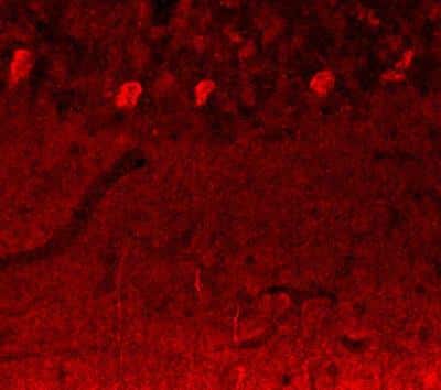 Immunohistochemistry of 10 micron cryostat sections of rat brain fixed with 4% formaldehyde by transcardial perfusion showing specific staining of Notch 3. 
