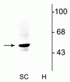 Western blot of rat spinal cord lysate (SC) showing specific immunolabeling of the ~48 kDa α1- and α2-subunits of the glycine receptor. Immunolabeling was absent from a rat hippocampal lysate (H), as the glycine receptor is not expressed in the hippocampus. 