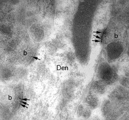 Electron micrograph of L21/32 hippocampal labelling using a post-embedding immunogold method. Immunoparticles (arrows) were observed in the postsynaptic densities of dendritic spines and dendritic shafts (Den) establishing asymmetrical synapses with axon terminals (b). Image courtesy of Rafael Lujan (Universidad de Castilla-La Mancha).