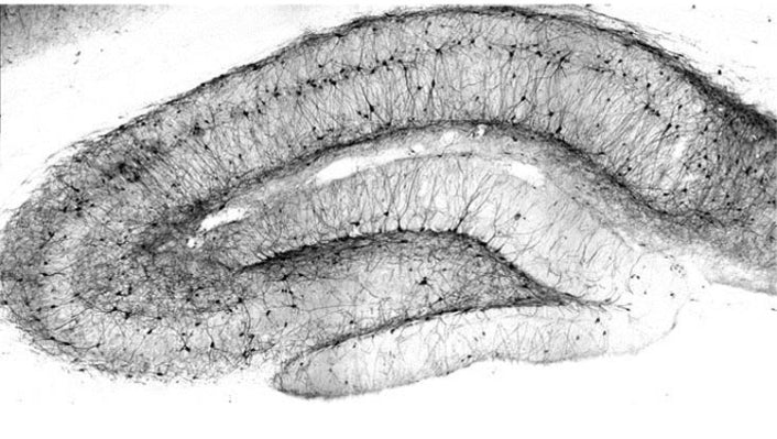 Adult rat hippocampus immunohistochemistry.