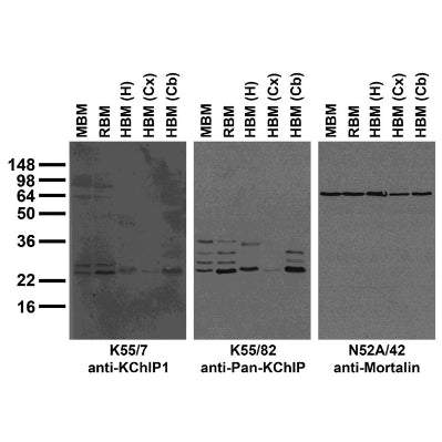 Immunoblot versus crude brain membranes from adult mouse (MBM), rat (RBM) and human hippocampus [HBM(H)], cerebral cortex [HBM(Cx)] and cerebellum [HBM(Cb)] probed with K55/7 (left), K55/82 (middle) and N52A/42 (right).