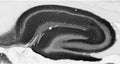 Adult rat hippocampus immunohistochemistry.
