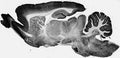 Adult rat brain immunohistochemistry.