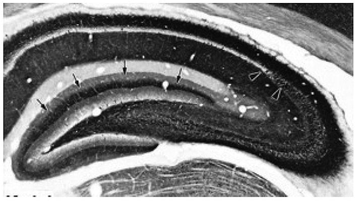 Adult rat brain hippocampus immunohistochemistry.