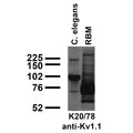 Immunoblot against crude C. elegans worm extracts and crude brain membranes from adult rat (RBM) probed with K20/78 TC supe.