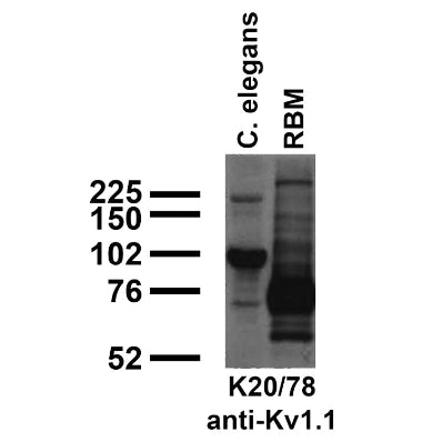 Immunoblot against crude C. elegans worm extracts and crude brain membranes from adult rat (RBM) probed with K20/78 TC supe.