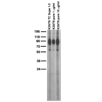 Adult brain membrane immunoblot.