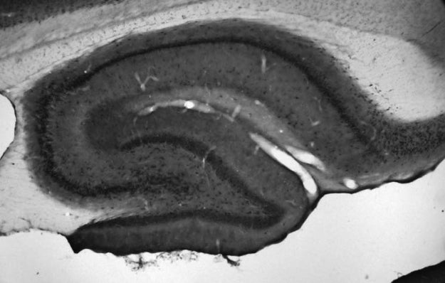 Adult rat hippocampus immunohistochemistry.