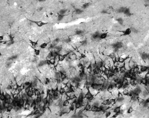 Adult rat dentate gyrus immunohistochemistry.