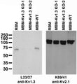 Immunoblot on adult rat brain membranes (RBM), and adult mouse brain membranes from two Kv1.3 knockout mice (MBM-Kv1.3-KO) and one wild-type mouse (MBM-WT). KO samples courtesy of Dr. Leonard Kaczmarek, Yale School of Medicine.