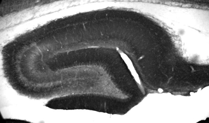 Adult rat hippocampus immunohistochemistry.
