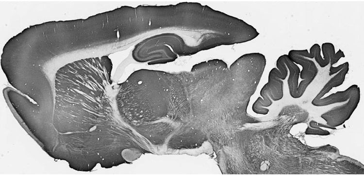 Adult rat brain immunohistochemistry.
