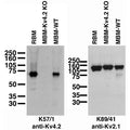 Immunoblot against crude brain membranes from adult rat (RBM) and wild-type (MBM-WT) and Kv4.2 knockout (MBM-Kv4.2-KO) mice probed with K57/1 (left) or K89/41 (right) TC supe.
