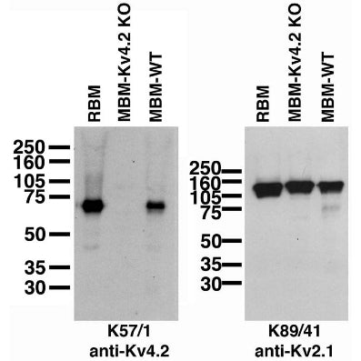 Immunoblot against crude brain membranes from adult rat (RBM) and wild-type (MBM-WT) and Kv4.2 knockout (MBM-Kv4.2-KO) mice probed with K57/1 (left) or K89/41 (right) TC supe.