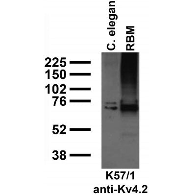 Immunoblot against crude C. elegans worm extracts and RBM.