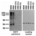 Immunoblot against crude membranes from whole mouse (MBM) or rat (RBM) brain and from human cerebellum [HBM(Cb)], cerebral cortex [HBM(Cx)] or hippocampus [HBM(H)] and probed with K57/1 (left) or N52A/42 loading control (right) TC supe.