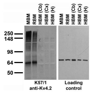 Immunoblot against crude membranes from whole mouse (MBM) or rat (RBM) brain and from human cerebellum [HBM(Cb)], cerebral cortex [HBM(Cx)] or hippocampus [HBM(H)] and probed with K57/1 (left) or N52A/42 loading control (right) TC supe.