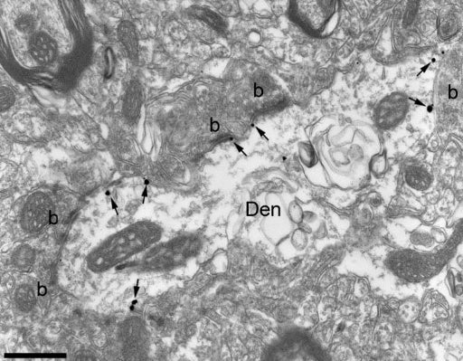 Electron micrograph shows K75/41 immunolabelling in the hippocampus using a pre-embedding immunogold method. Immunogold particles (arrows) were observed along the extrasynaptic plasma membrane of dendritic shafts (Den) of interneurons establishing synaptic contacts with excitatory axon terminals (b). Scale bar = 500 nm. Courtesy Dr. Rafael Lujan (Universidad de Castilla-La Mancha).