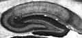 Adult rat hippocampus immunohistochemistry.