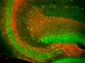 Immunofluorescence staining of hippocampal CA3 of adult WT and Slo1 KO mice with L6/60 (red) and Kv2.1 rabbit polyclonal (green).