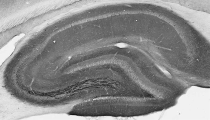 Adult rat hippocampus immunohistochemistry.