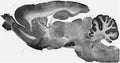 Adult rat whole brain immunohistochemistry.
