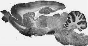 Adult rat whole brain immunohistochemistry.