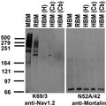 Immunoblot against crude membrane fractions from whole mouse (MBM) or rat (RBM) brain and from human hippocampus [HBM(H)], cerebral cortex [HBM(Cx)] or cerebellum [HBM(Cb)] and probed with K69/3 (left) or N52A/42 (right) TC supe.
