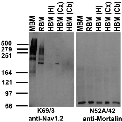 Immunoblot against crude membrane fractions from whole mouse (MBM) or rat (RBM) brain and from human hippocampus [HBM(H)], cerebral cortex [HBM(Cx)] or cerebellum [HBM(Cb)] and probed with K69/3 (left) or N52A/42 (right) TC supe.