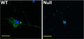 Cerebellar granule cells, 16 days in culture, obtained from wild-type (WT) and Nav1.6-null “Null” mice. K87A/10=green. DAPI=blue. Scale bar = 20 μm. Images courtesy of Drs. L. M. Sharkey and M. H. Meisler, University of Michigan School of Medicine.
