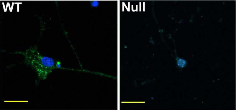 Cerebellar granule cells, 16 days in culture, obtained from wild-type (WT) and Nav1.6-null “Null” mice. K87A/10=green. DAPI=blue. Scale bar = 20 μm. Images courtesy of Drs. L. M. Sharkey and M. H. Meisler, University of Michigan School of Medicine.
