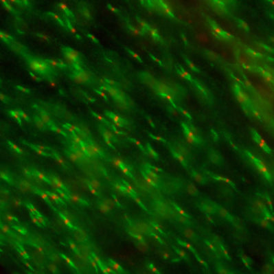 Adult rat optic nerve immunofluorescence staining K87A/10=red Rabbit anti-Caspr=green Image courtesy of Dr. Matthew Rasband (Baylor College of Medicine).