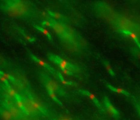 (Closeup) Adult rat optic nerve immunofluorescence staining K87A/10=red Rabbit anti-Caspr=green Image courtesy of Dr. Matthew Rasband (Baylor College of Medicine).