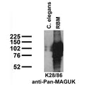 Immunoblot against crude C. elegans worm extracts and crude brain membranes from adult rat (RBM) probed with K28/86 TC supe.