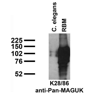Immunoblot against crude C. elegans worm extracts and crude brain membranes from adult rat (RBM) probed with K28/86 TC supe.