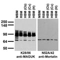 Immunoblot against crude membrane fractions from whole mouse (MBM) or rat (RBM) brain and from human cerebellum [HBM(Cb)], cerebral cortex [HBM(Cx)] or hippocampus [HBM(H)] probed with K28/86 (left) or N52A/42 (right) TC supe.