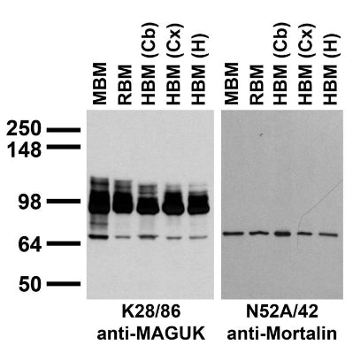 Immunoblot against crude membrane fractions from whole mouse (MBM) or rat (RBM) brain and from human cerebellum [HBM(Cb)], cerebral cortex [HBM(Cx)] or hippocampus [HBM(H)] probed with K28/86 (left) or N52A/42 (right) TC supe.