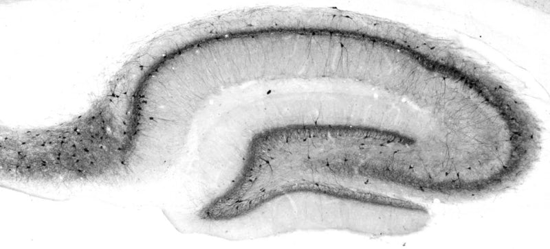 Adult rat hippocampus immunohistochemistry.