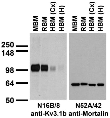 Immunoblots on brain membranes prepared from whole rat (RBM) and mouse (MBM) brain, and from human cerebral cortex [HBM(Cx)] and hippocampus [HBM(H)].