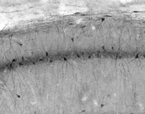 Adult rat hippocampus CA1 immunohistochemistry.