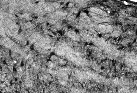 Adult rat medial vestibular nucleus immunohistochemistry.