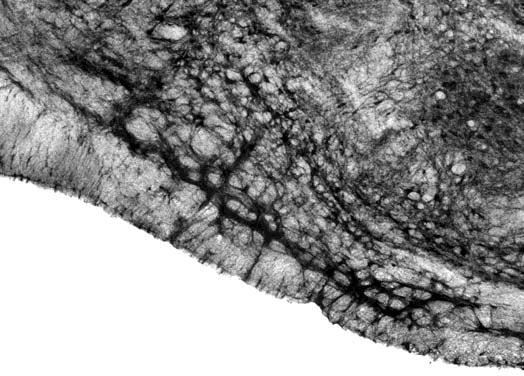 Adult rat trapezoid body immunohistochemistry.