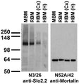 Immunoblot against brain membranes from adult rat (RBM), mouse (MBM) or human cerebral cortex [HBM(Cx)] or hippocampus [HBM(H)] probed with N3/26 (left) or N52A/42 (right) TC supe.