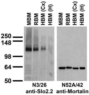 Immunoblot against brain membranes from adult rat (RBM), mouse (MBM) or human cerebral cortex [HBM(Cx)] or hippocampus [HBM(H)] probed with N3/26 (left) or N52A/42 (right) TC supe.