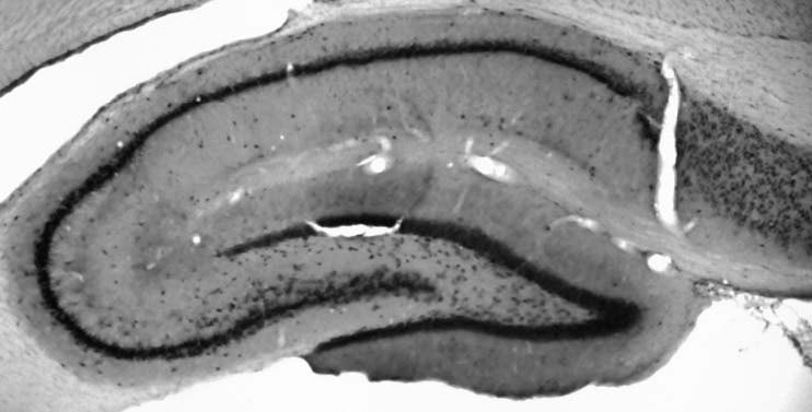 Adult rat hippocampus immunohistochemistry.