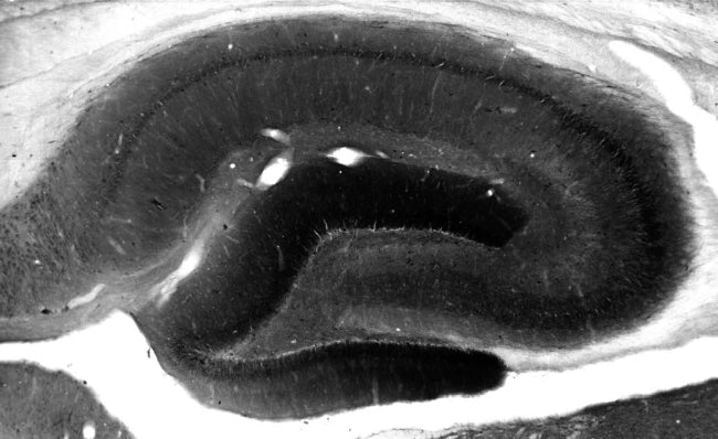 Adult rat hippocampus immunohistochemistry.