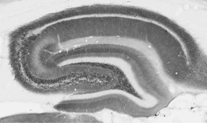 Adult rat hippocampal immunohistochemistry.