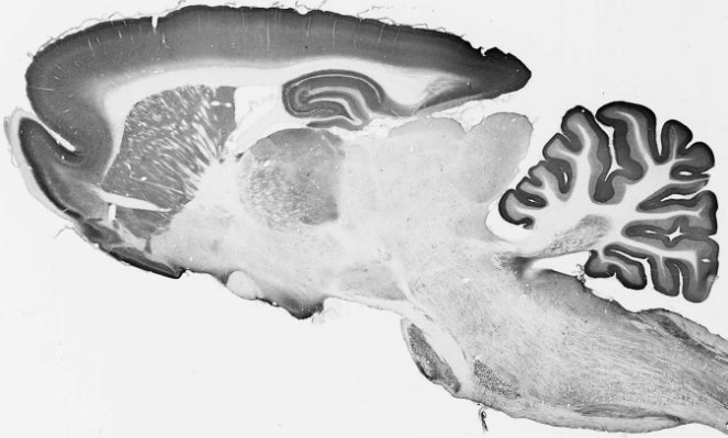 Adult rat whole brain immunohistochemistry.